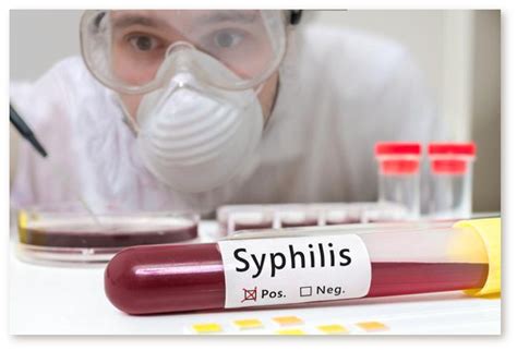 Cat Dureaza Tratamentul Pentru Sifilis