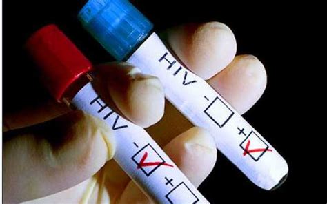 La Cat Timp Se Face Testul Hiv